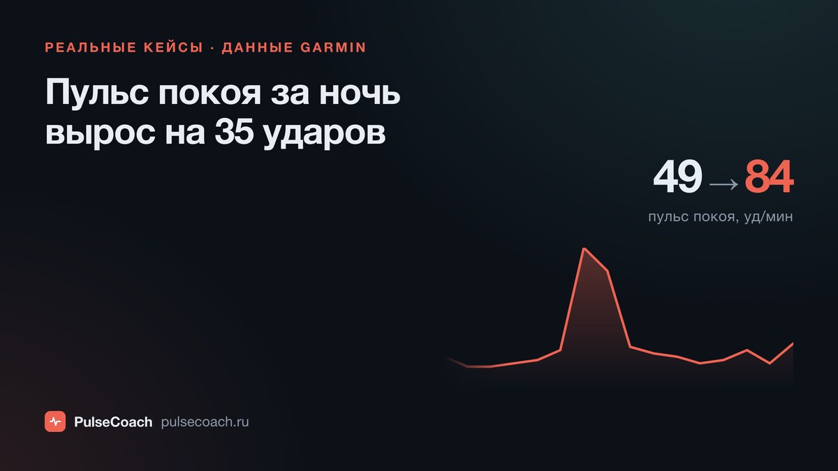 Пульс покоя за ночь вырос на 35 ударов: как часы заметили болезнь раньше меня
